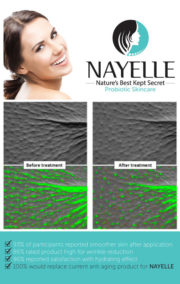 Before and After NAYELLE Skincare