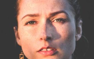 rosacea skincare