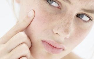 Caring for your Sensitive Skin