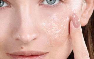 Air Pollution - Your Skin's Enemy